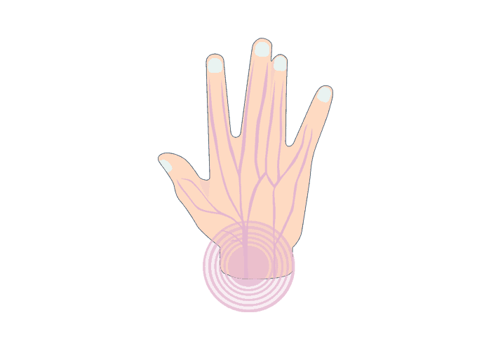 illustrations of nerve in the hand with a carpal tunnel